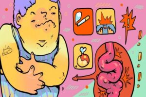 divertikulit_cover_1599227949-1140x570