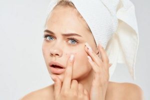 a-woman-with-a-towel-on-her-head-squeezes-out-acne-on-her-face-problem-skin-cosmetology-dermatology_163305-68937-600x379