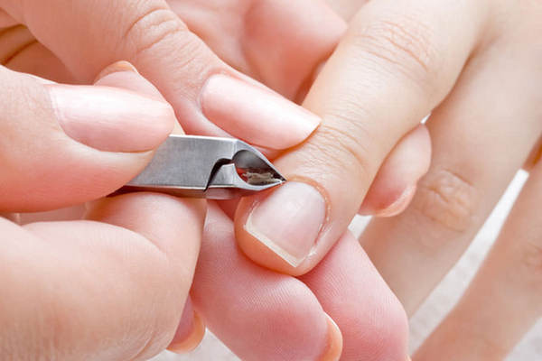 Каким образом на пальцах образуются заусеницы и что с ними можно сделать