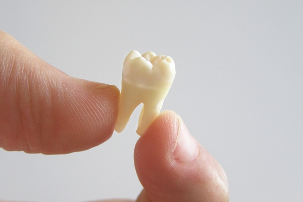 Выпадение зубов: причины и профилактика