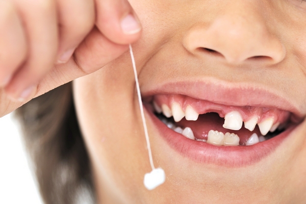 Выпадение зубов: причины и профилактика