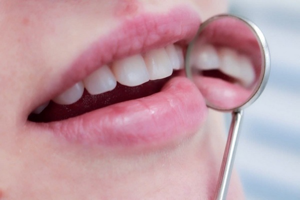 Стоматологи составили список продуктов, оказывающих разрушительное воздействие на зубы