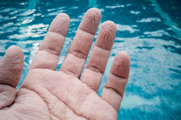 Почему ваша кожа на пальцах кривится в воде – невероятные факты, которые точно вас удивят.