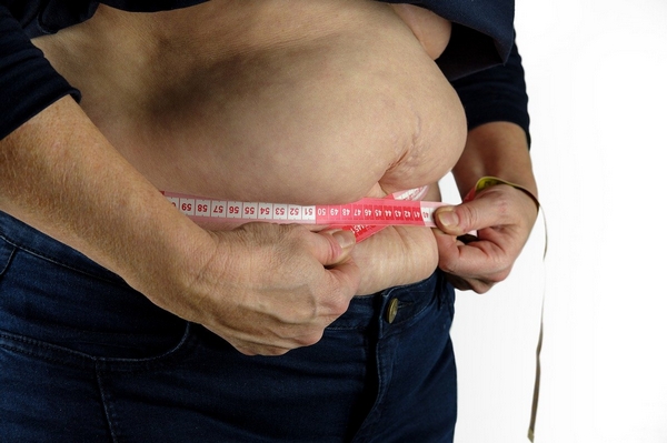 Как победить ожирение с помощью бариатрии?