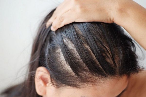 Болят корни волос на голове: основные причины и как справиться